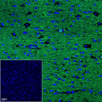SNAP25 Recombinant Rabbit mAb (S-1828-67)
