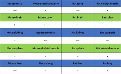 YTHDF1 Recombinant Rabbit mAb (S-3433-13)