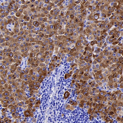 PMEL/Melanoma gp100 Recombinant Rabbit mAb (SDT-3393)
