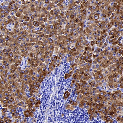 PMEL/Melanoma gp100 Recombinant Rabbit mAb (SDT-3393)