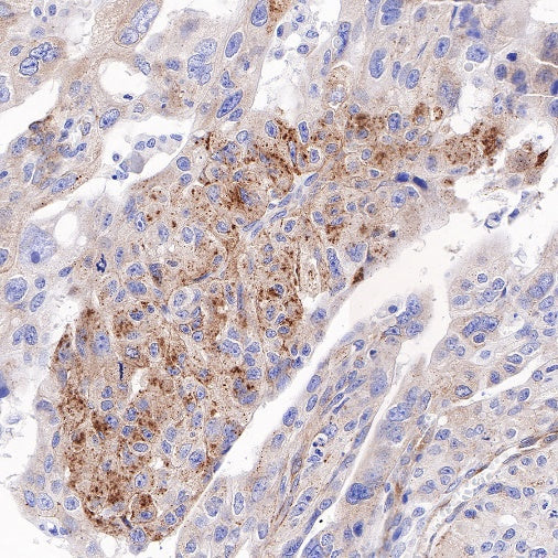 Amyloid Precursor Protein Recombinant Rabbit mAb (S-806-13)