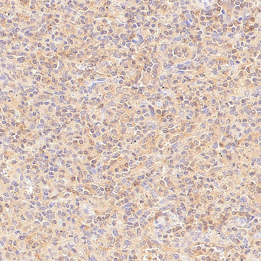 Rad51C Recombinant Rabbit mAb (S-4505-32)