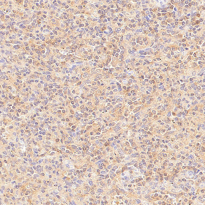 Rad51C Recombinant Rabbit mAb (S-4505-32)