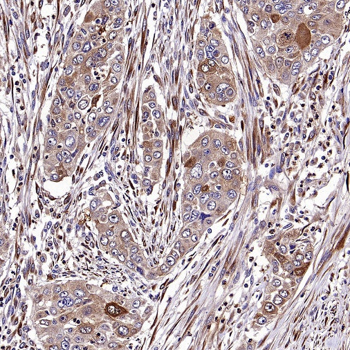 IGF2BP2 Rabbit Polyclonal Antibody