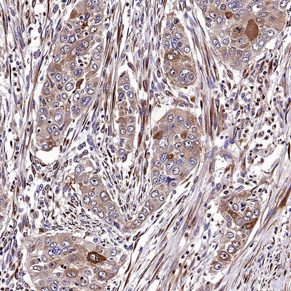 IGF2BP2 Rabbit Polyclonal Antibody