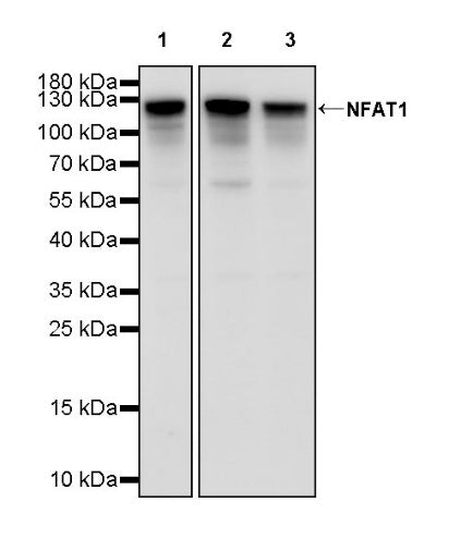 NFAT1 Recombinant Rabbit mAb (S-1797-224)