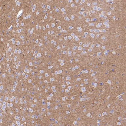 FYN Recombinant Rabbit mAb (S-2157-52)