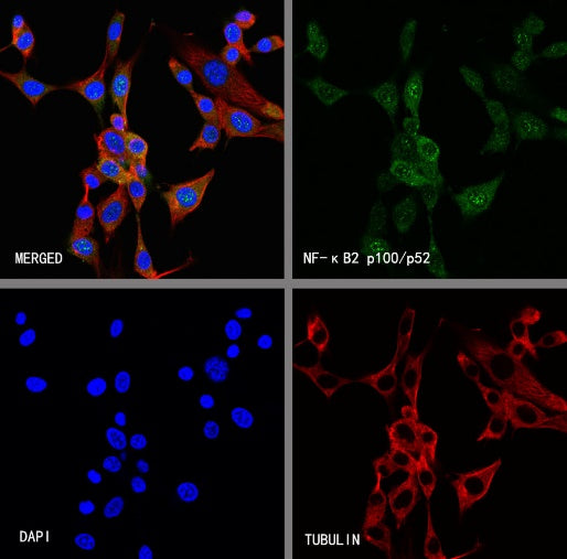 NF-κB2 p100/p52 Recombinant Rabbit mAb (S-2502-208)