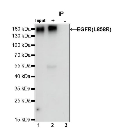 EGFR (L858R) Recombinant Rabbit mAb (SDT-421-202)