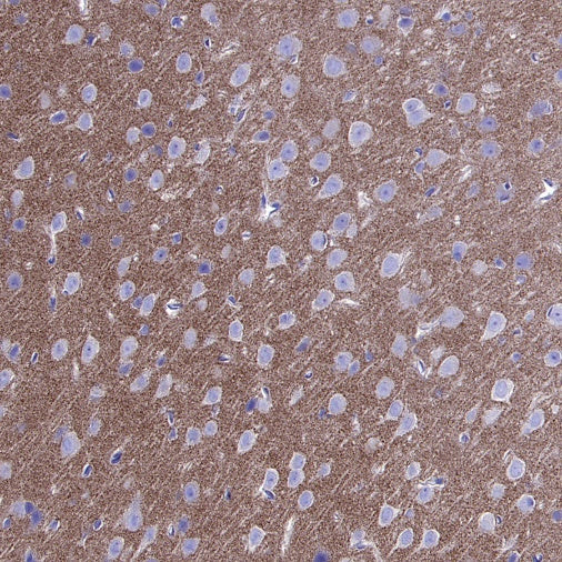 Cortactin Recombinant Rabbit mAb (S-1303-10)
