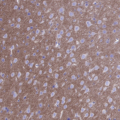 Cortactin Recombinant Rabbit mAb (S-1303-10)