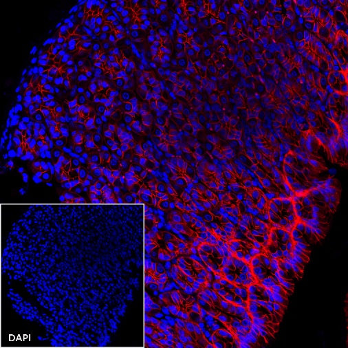 E-Cadherin Recombinant Rabbit mAb (Alexa Fluor® 594 Conjugate) (S-438-5)
