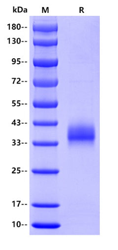 SARS-CoV-2 (KP.2/Omicron) RBD Protein, His tag