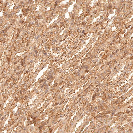 Argonaute-2 Recombinant Rabbit mAb (S-1826-47)