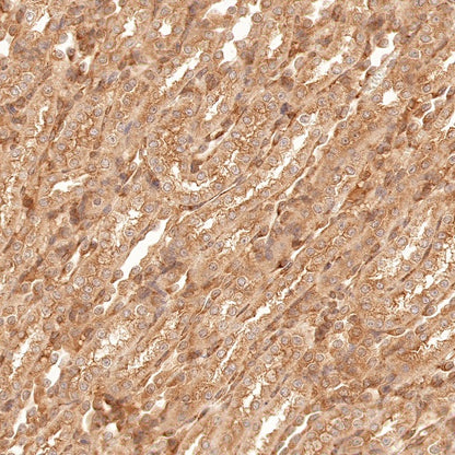 Argonaute-2 Recombinant Rabbit mAb (S-1826-47)