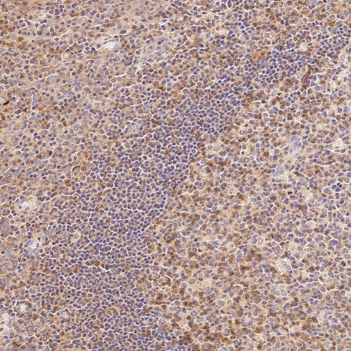 CD100/Semaphorin-4D Recombinant Rabbit mAb (S-3651-16)