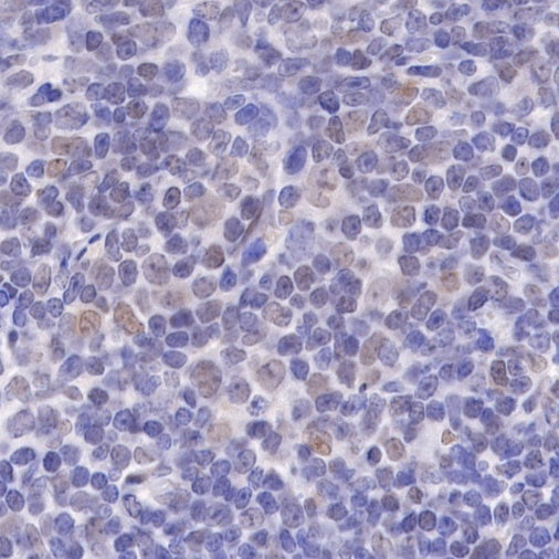 PMS2 Recombinant Rabbit mAb (SDT-111-307)