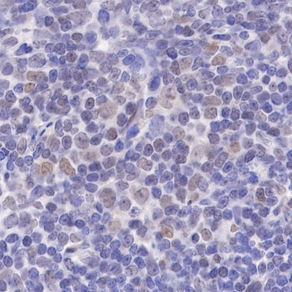 PMS2 Recombinant Rabbit mAb (SDT-111-307)