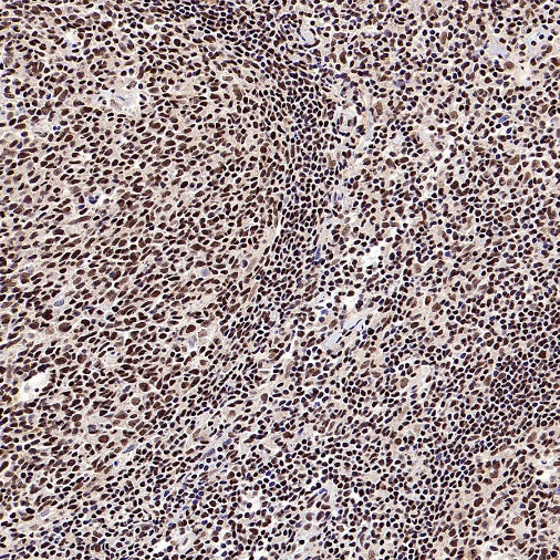 CTCF Recombinant Rabbit mAb (S-1822-42)
