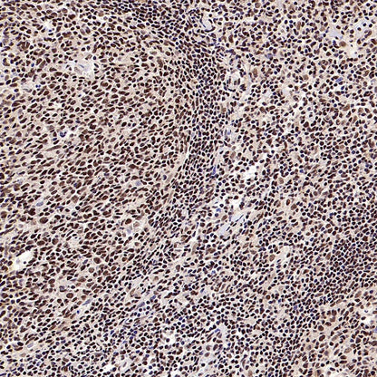 CTCF Recombinant Rabbit mAb (S-1822-42)