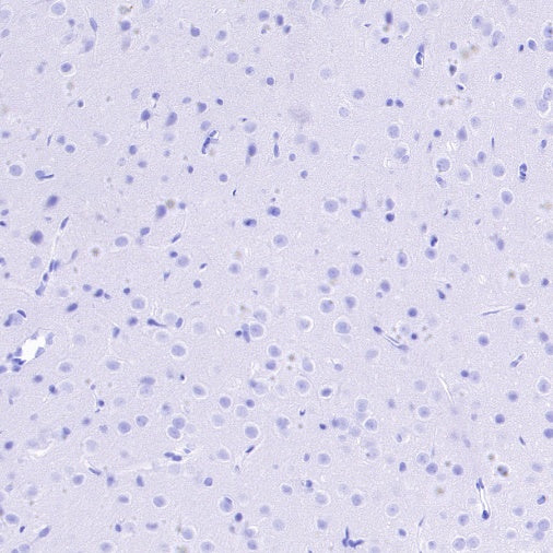 S-RMab® DAZL Recombinant Rabbit mAb (S-1588-3)