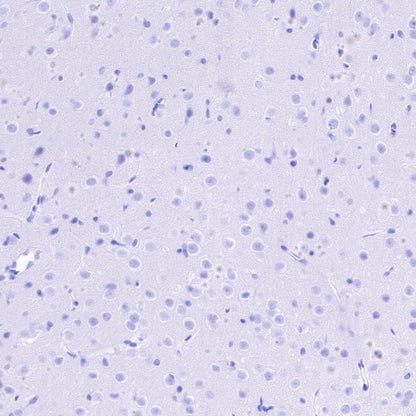 S-RMab® DAZL Recombinant Rabbit mAb (S-1588-3)