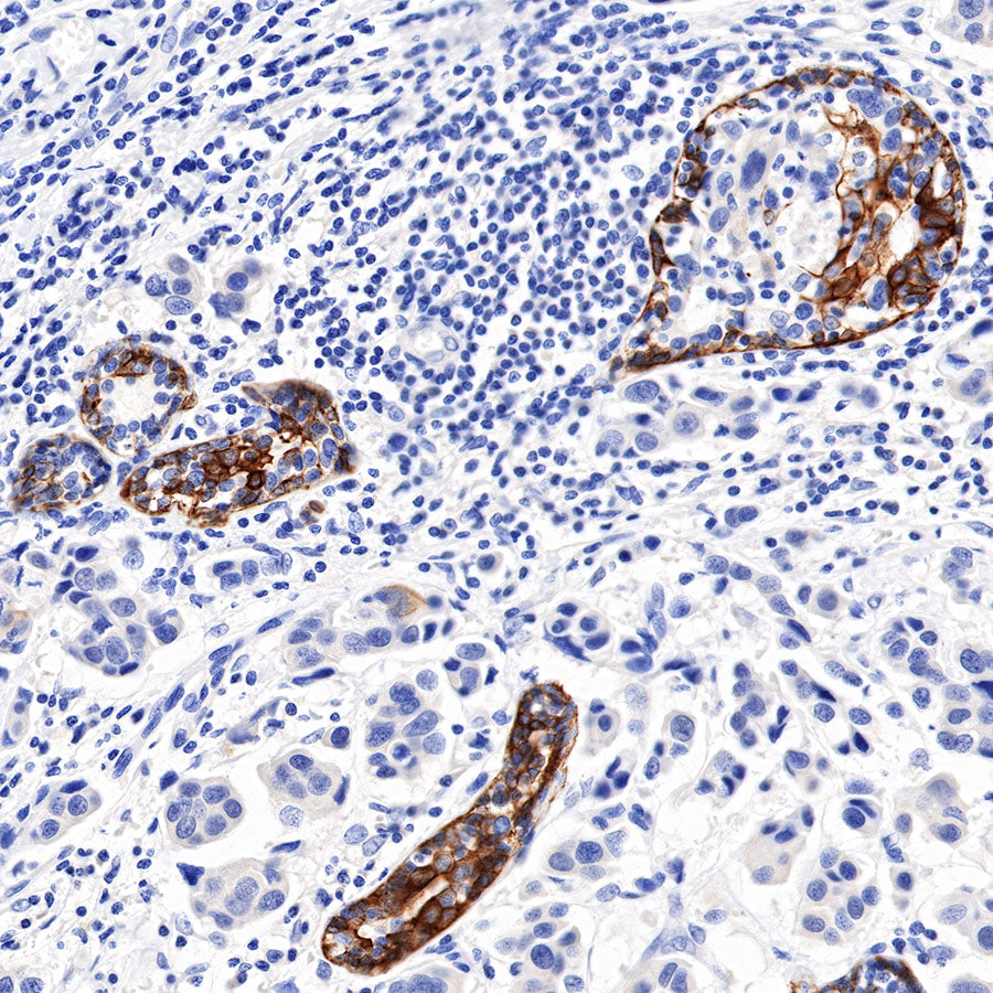 S-RMab® CK5/6 Recombinant Rabbit mAb,PBS Only (SDT-P004)