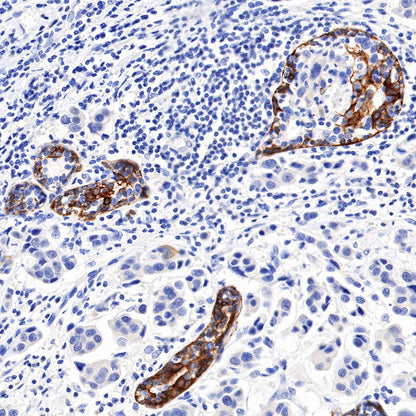 S-RMab® CK5/6 Recombinant Rabbit mAb,PBS Only (SDT-P004)