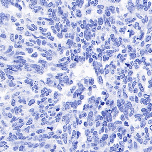 Inhibin alpha Recombinant Rabbit mAb (SDT-R307)