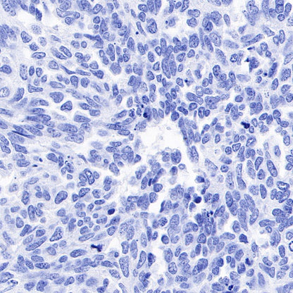 Inhibin alpha Recombinant Rabbit mAb (SDT-R307)