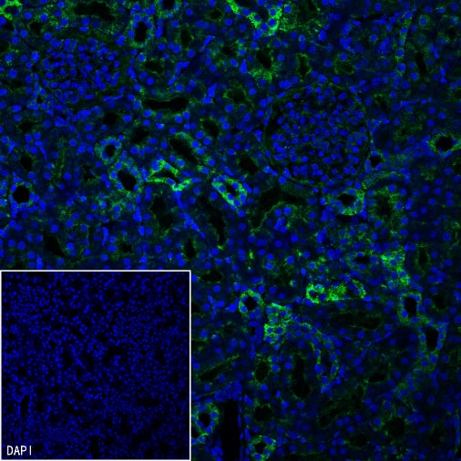 SLC8A1 Recombinant Rabbit mAb (S-3100-17)