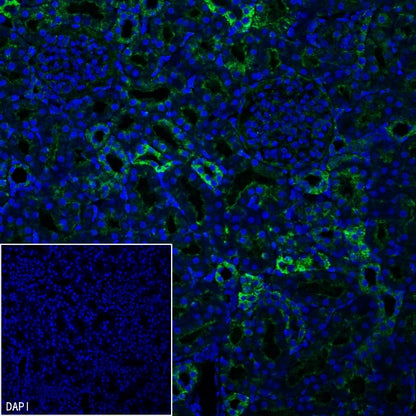 SLC8A1 Recombinant Rabbit mAb (S-3100-17)