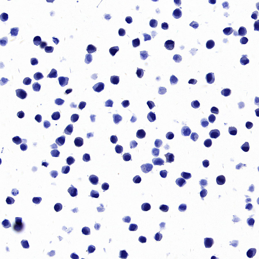 STEAP1+STEAP1B1+STEAP1B2 Recombinant Rabbit mAb (S-3226-137)