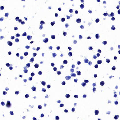 STEAP1+STEAP1B1+STEAP1B2 Recombinant Rabbit mAb (S-3226-137)