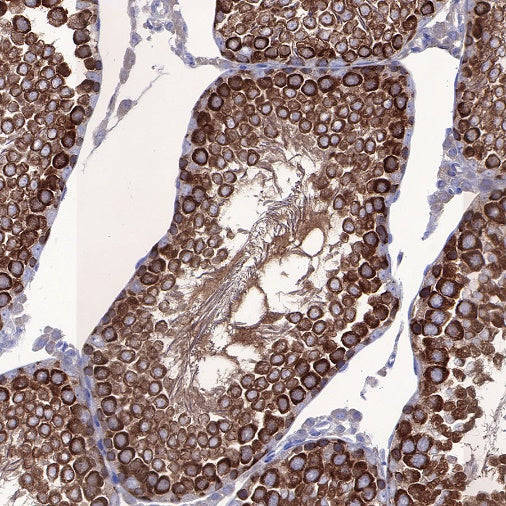 STIP1 Recombinant Rabbit mAb (S-680-39)