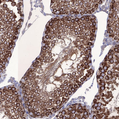 STIP1 Recombinant Rabbit mAb (S-680-39)