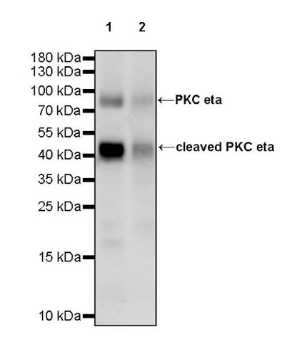 PKC eta Recombinant Rabbit mAb (S-1053-35)