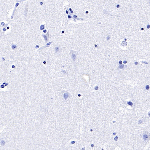 Mouse Anti-Human CD45RO Antibody (UCHL1)