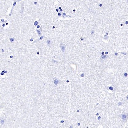 Mouse Anti-Human CD45RO Antibody (UCHL1)