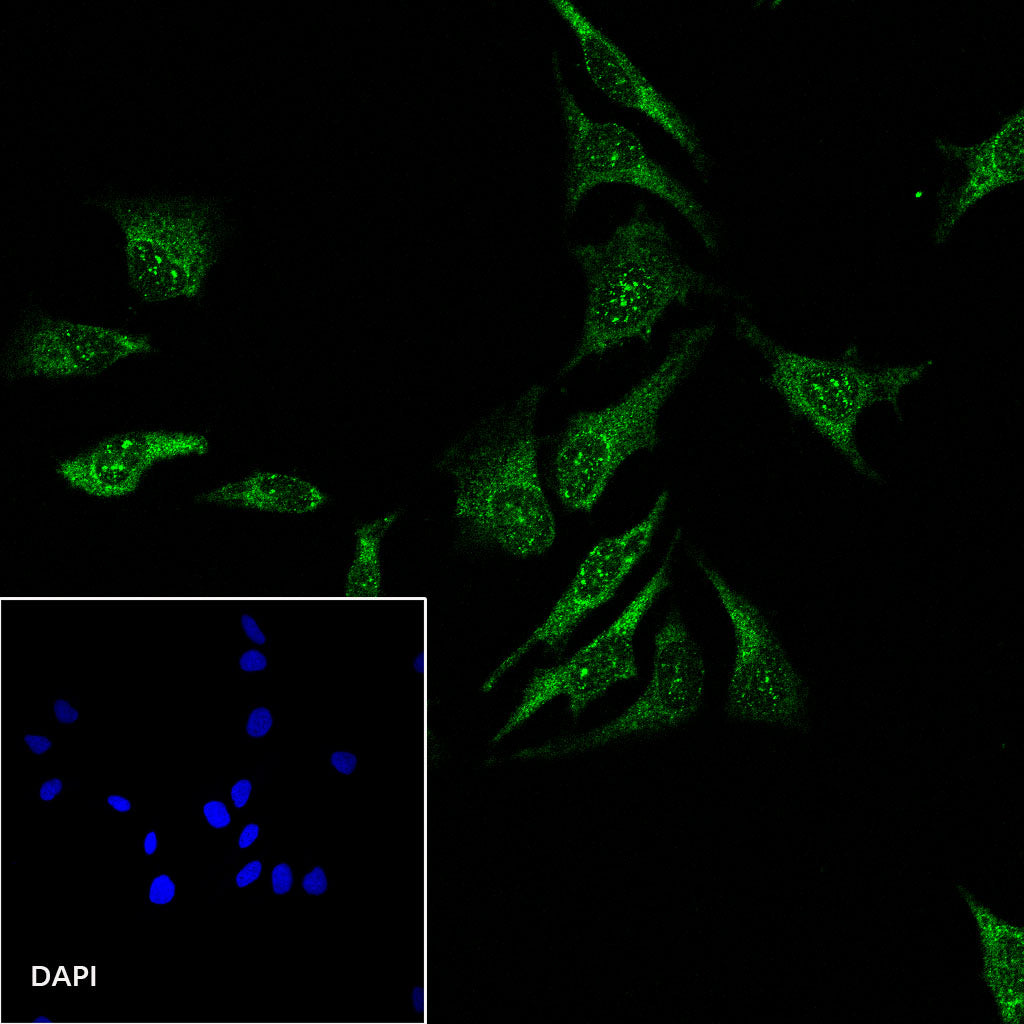 S-RMab® Stat6 Recombinant Rabbit mAb (SDT-337-32)