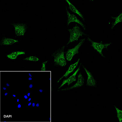 S-RMab® Stat6 Recombinant Rabbit mAb (SDT-337-32)