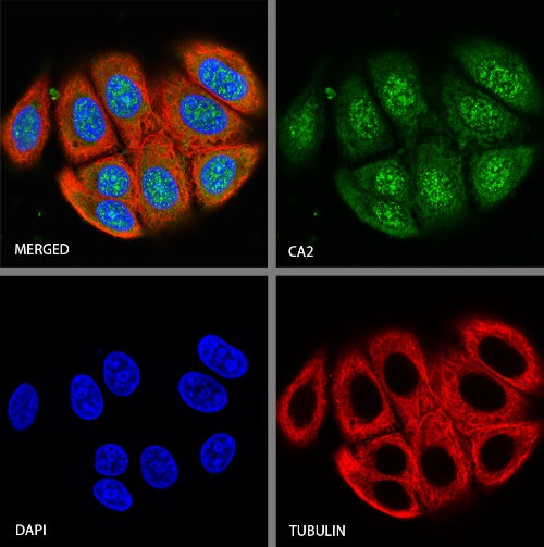 CA2 Rabbit Polyclonal Antibody