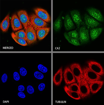 CA2 Rabbit Polyclonal Antibody