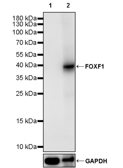 FOXF1 Recombinant Rabbit mAb (S-2808-1)