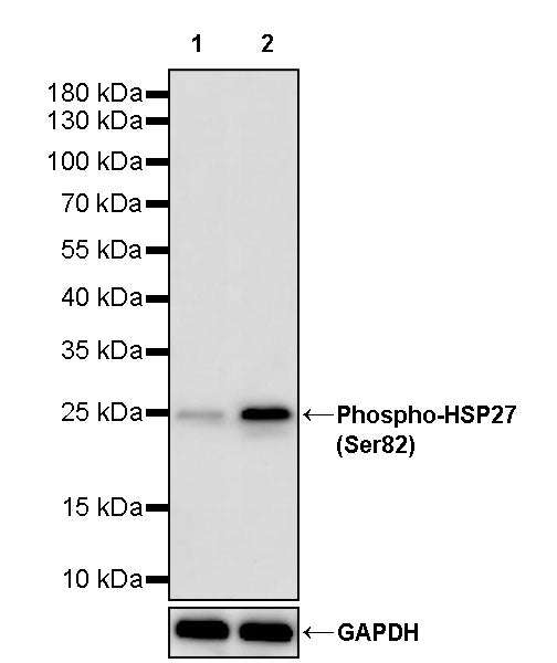 Phospho-HSP27 (Ser82) Recombinant Rabbit mAb (S-4792)
