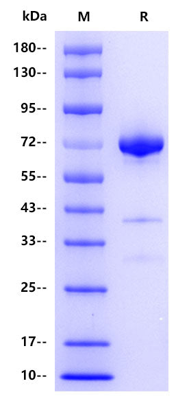 AFP His Tag Protein, Human