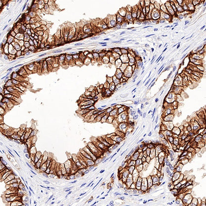 CD46 Recombinant Rabbit mAb (S-668-119)
