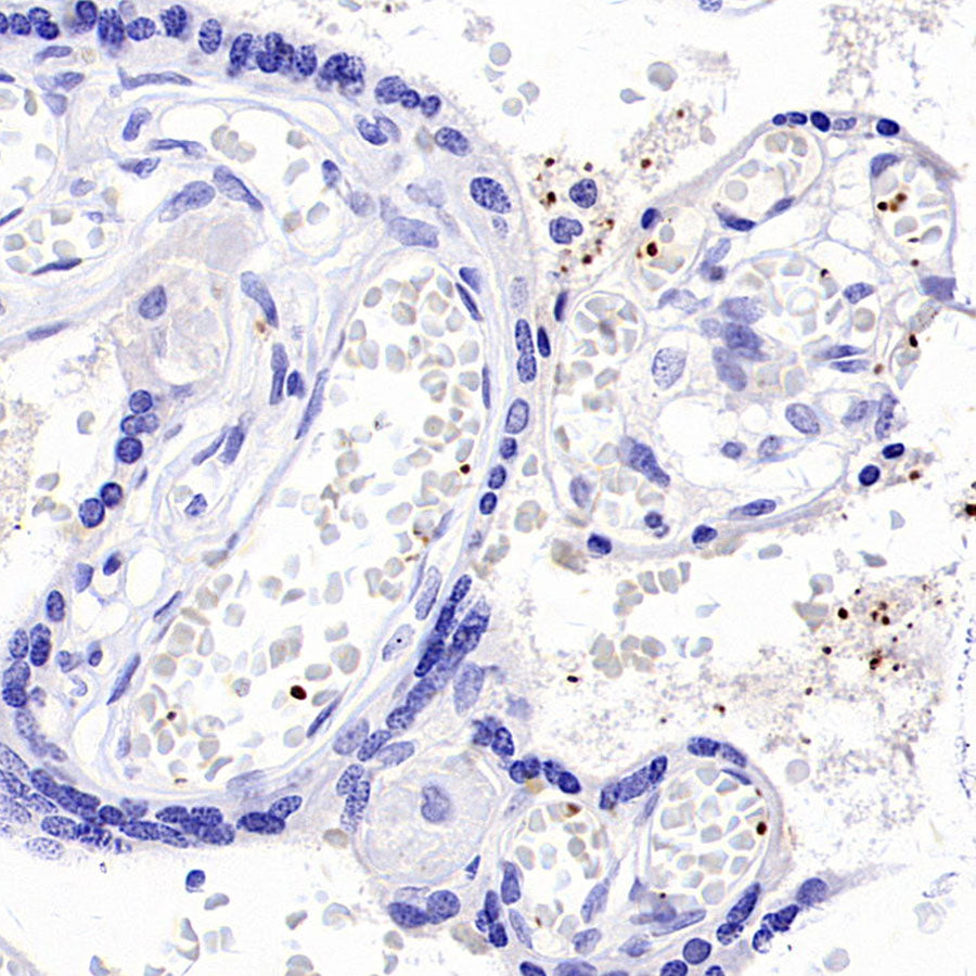 PF4 Recombinant Rabbit mAb (SDT-4218)