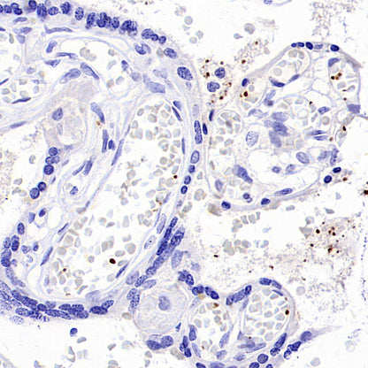 PF4 Recombinant Rabbit mAb (SDT-4218)