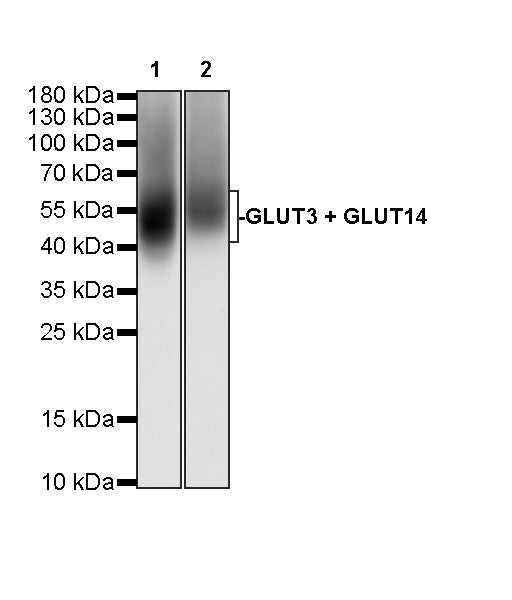 GLUT3 + GLUT14 Recombinant Rabbit mAb (S-5945)